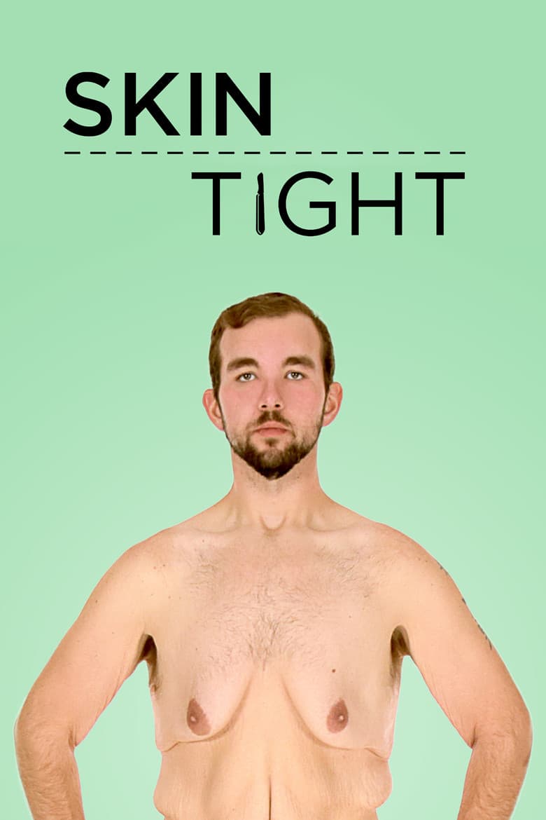 Skin Tight: la mia nuova pelle (St. 2 - Ep. 3)